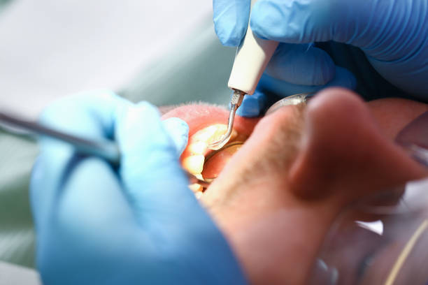 Best Emergency TMJ Treatment in Glen Gardner, NJ