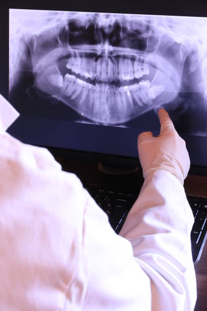 Best Emergency Dental Care for Broken or Chipped Teeth in Glen Gardner, NJ