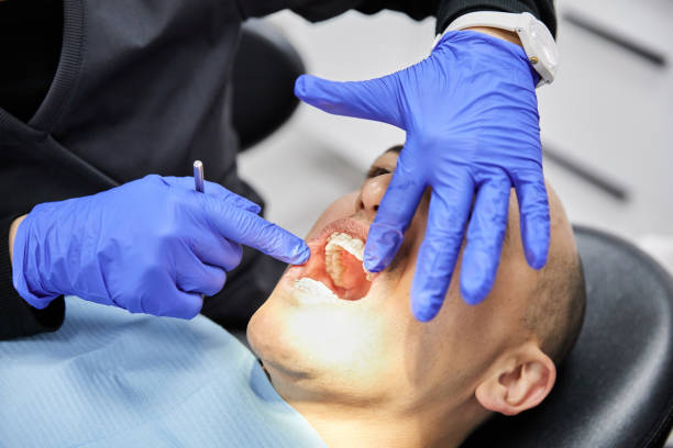 Best Emergency Treatment for Dental Infections or Abscesses in Glen Gardner, NJ